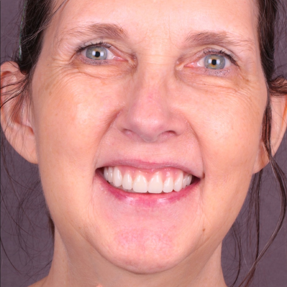 Meet your Posher, Susan